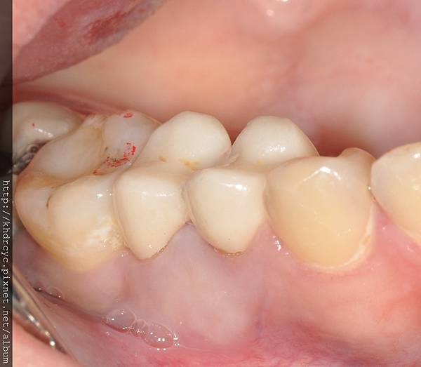 鑄心5.jpg 鑄心5.jpg