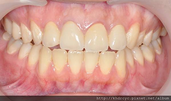 高雄牙醫/左營牙醫/牙醫推薦/高雄植牙 高雄牙醫/左營牙醫/牙醫推薦/高雄植牙