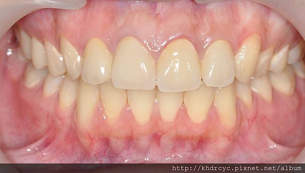 高雄牙醫/左營牙醫/牙醫推薦/高雄植牙 高雄牙醫/左營牙醫/牙醫推薦/高雄植牙