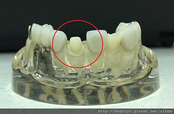 高雄牙醫/左營牙醫/牙醫推薦/高雄植牙 高雄牙醫/左營牙醫/牙醫推薦/高雄植牙