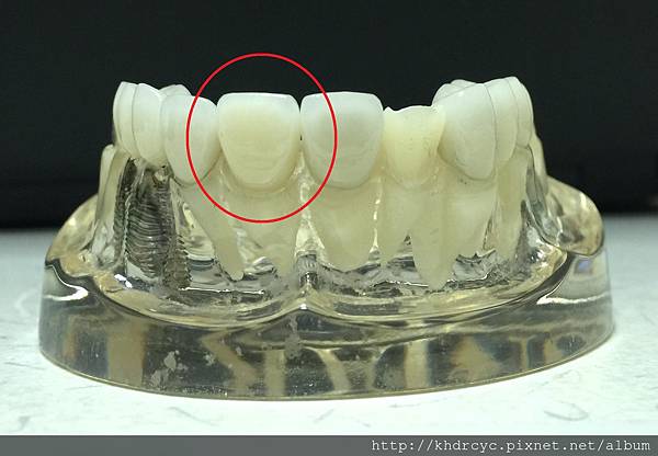 高雄牙醫/左營牙醫/牙醫推薦/高雄植牙 高雄牙醫/左營牙醫/牙醫推薦/高雄植牙