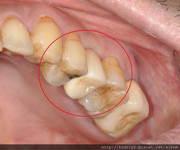 高雄牙醫/左營牙醫/牙醫推薦/高雄植牙 高雄牙醫/左營牙醫/牙醫推薦/高雄植牙