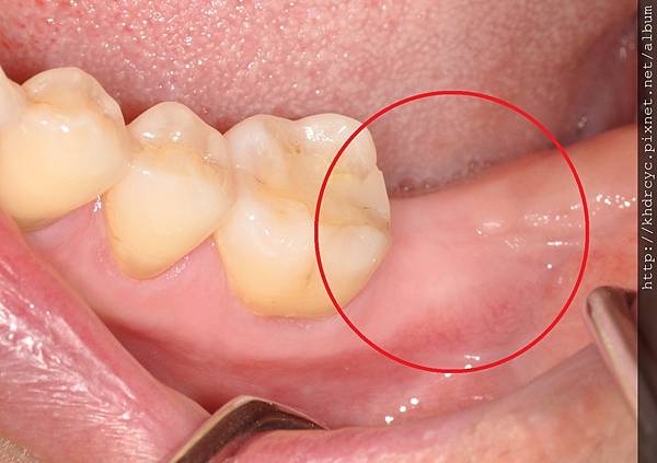 高雄牙醫/左營牙醫/牙醫推薦/高雄植牙 高雄牙醫/左營牙醫/牙醫推薦/高雄植牙