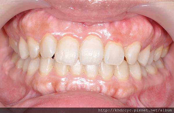 高雄牙醫/左營牙醫/牙醫推薦/高雄植牙 高雄牙醫/左營牙醫/牙醫推薦/高雄植牙