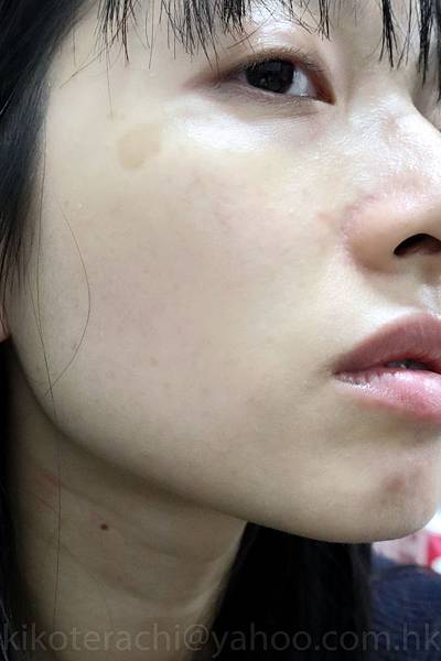 before.jpg before.jpg