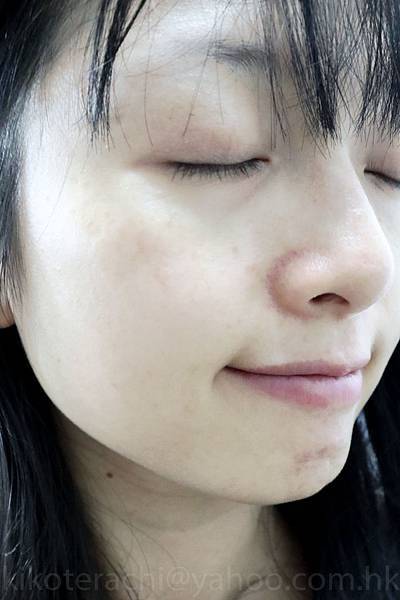 after after