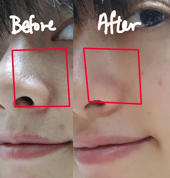 pore_b4af.jpg pore_b4af.jpg