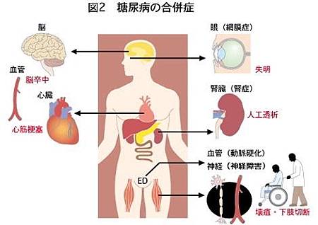 糖尿病03 糖尿病03
