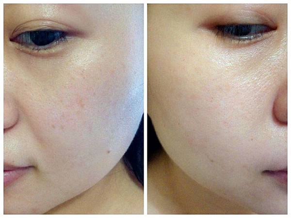 VICHY薇姿15%維他命C超導安瓶,安瓶推薦,維他命C,加強提亮