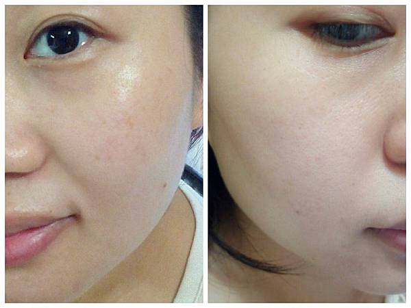 VICHY薇姿15%維他命C超導安瓶,安瓶推薦,維他命C,加強提亮