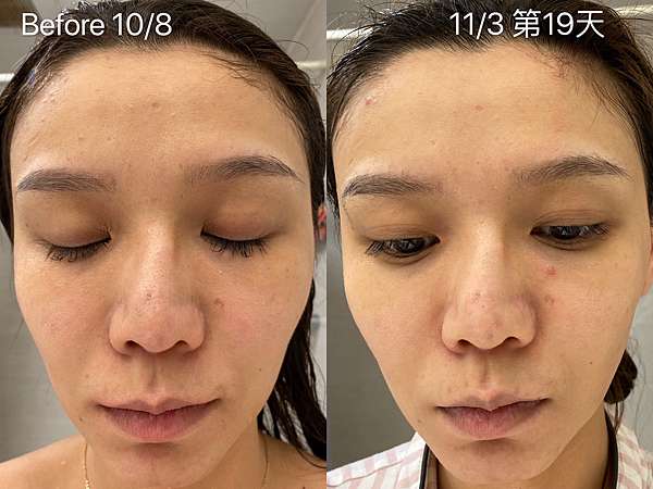 為什麼我停用皙之密了 無修圖無濾鏡無效棄坑使用心得紀錄 Kimmy Fun 痞客邦