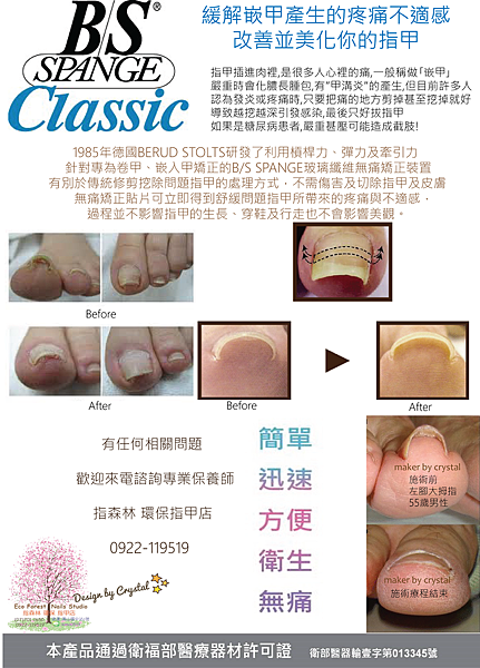 BS嵌甲貼片.png BS嵌甲貼片.png