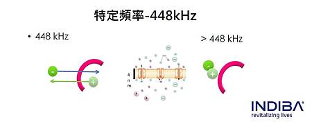 【Kiny愛開箱】紅遍歐美最夯無痛電波技術你一定要來試試！！