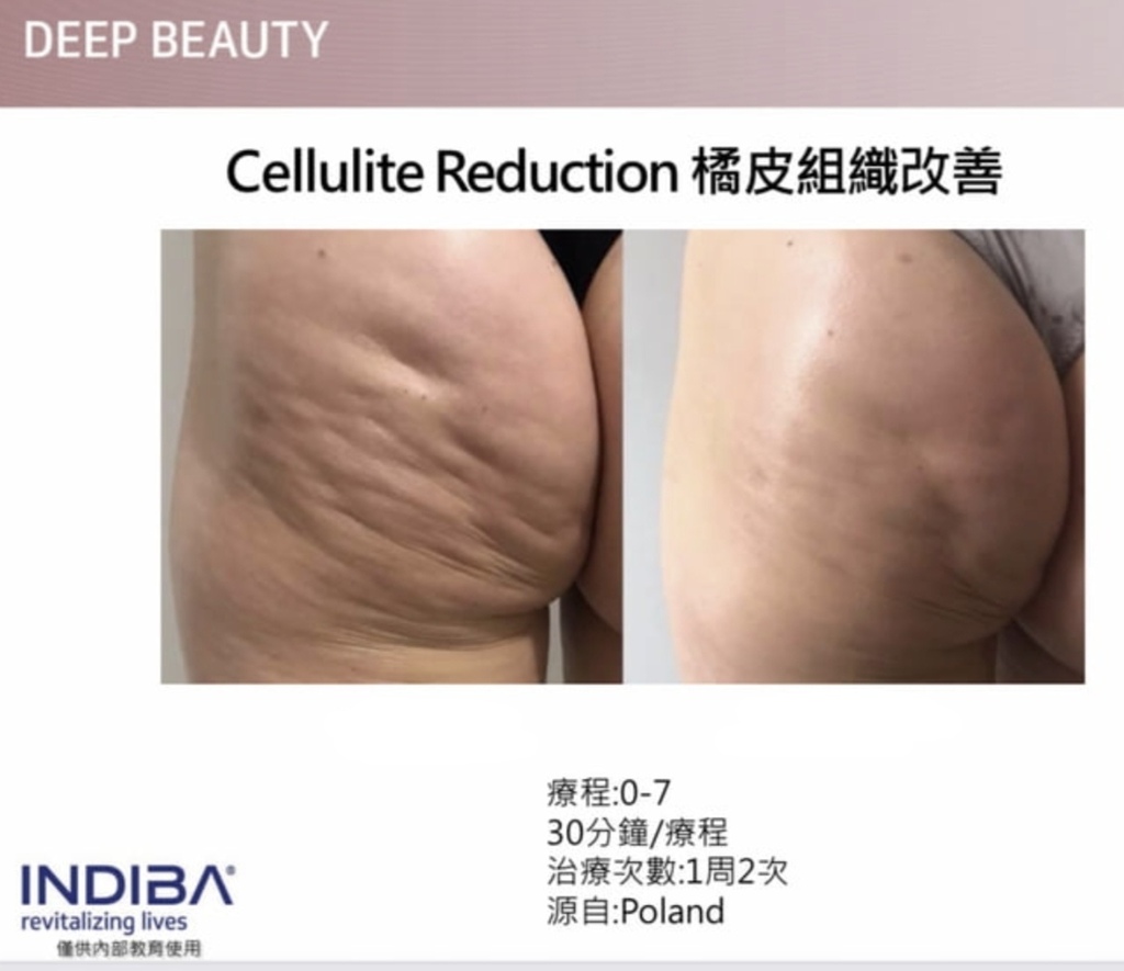 1679087216795.jpg 1679087216795.jpg