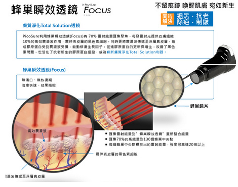 Picosure蜂巢皮秒雷射755蜂巢皮秒雷射蜂巢瞬效透鏡淨膚雷射飛梭雷射術後保養除斑除毛孔細紋凹疤2016凱蒂醫美 價格推薦06