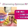 夏天私密處感染除陰毛除比基尼線全除花瓣電波大陰唇小陰唇過長私密處暗沉美白 (2)