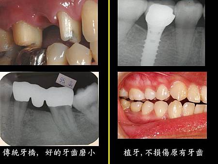 投影片2.JPG