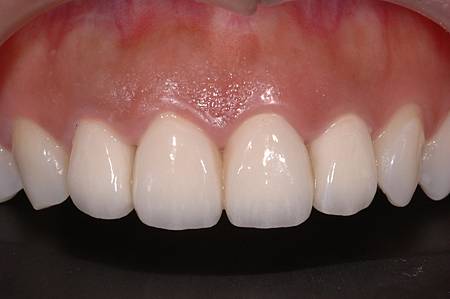 DSC_9409.JPG DSC_9409.JPG