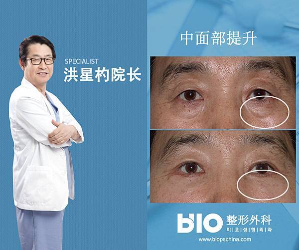 006CdbnPzy78eRsC4Md2d&690.jpg