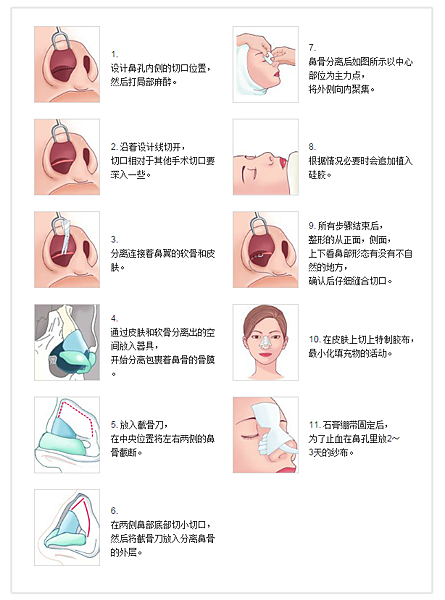 006p9jLGzy7hXuWSRSF81&690 - 복사본.png