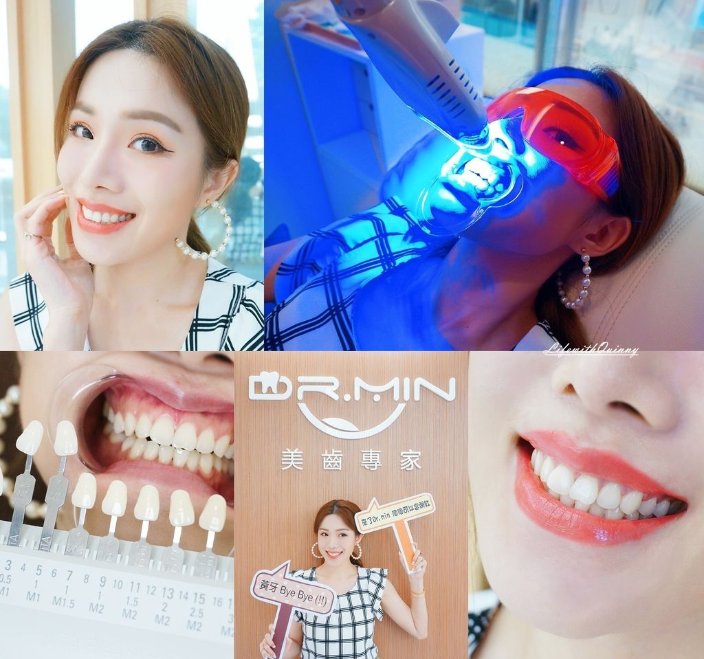 Dr.Min桃園牙齒淨白推薦,15分鐘牙齒白上加白 Dr.Min桃園牙齒美白推薦-冷光美白推薦