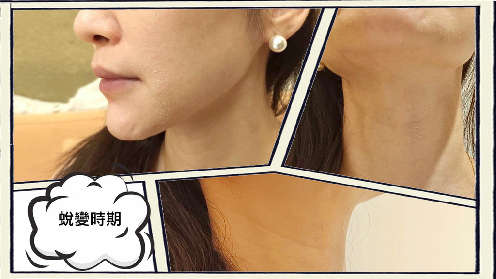 WiQO UNO 醫美前打底 醫美後維持 液態水光肌風靡歐洲 WiQO UNO 醫美前打底 醫美後維持 液態水光肌風靡歐洲