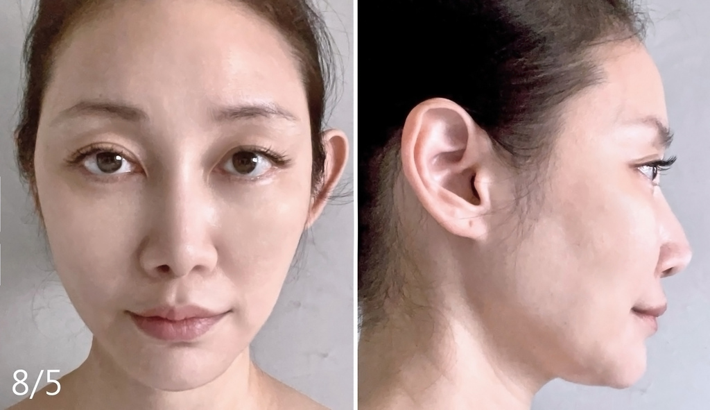 首發推薦｜美博士超V反重力精華 先嗅吸 後拉V  反重力不往