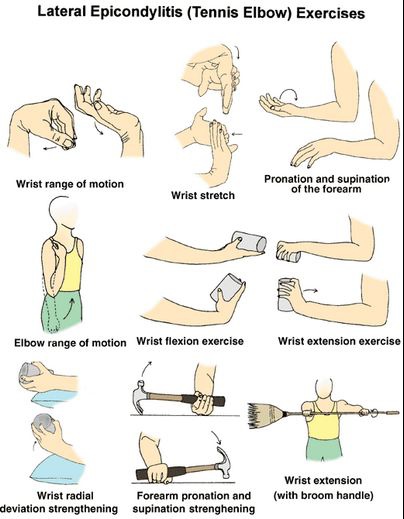 不打網球也會得的 網球肘 圖文分享 古德美式徒手整復 高雄 脊椎 酸痛 推拿 整骨 正骨 按摩 徒手 整脊 痞客邦