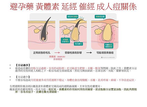 痘痘 延伸衛教 洗卸 飲食 壓力 健檢_220420_10.jpg