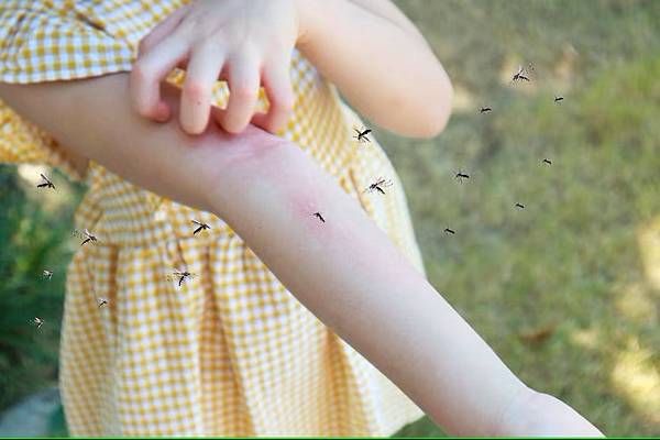 little-girl-has-skin-rash-allergy-itchy-her-arm-from-mosquito-bite_293060-14791