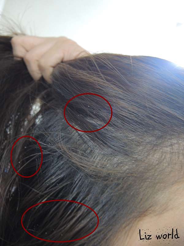 Aromase艾瑪絲頭皮屑問題三步驟洗護組 脂漏性皮膚炎日常清潔可用 Liz Chiang 栗子醬 痞客邦