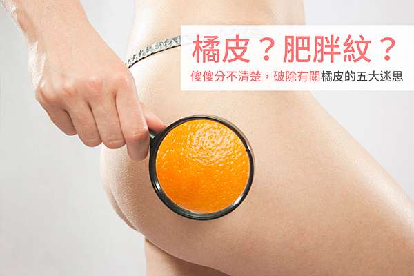 橘皮 肥胖紋 傻傻分不清楚 破除有關橘皮的五大迷思 美肌博士 范爺皮秒picosure755蜂巢皮秒雷射sculpsure蜂巢透鏡除皺淨膚雷射飛梭雷射fda雙波皮秒755 532雙波蜂巢皮秒二代皮秒超皮秒減肥瘦身抽脂體雕