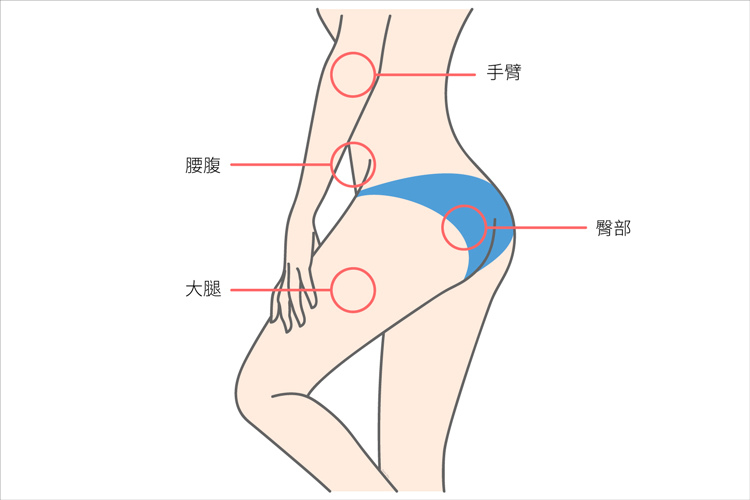 4D馬甲電波VELA電波馬甲橘皮肥胖03.jpg