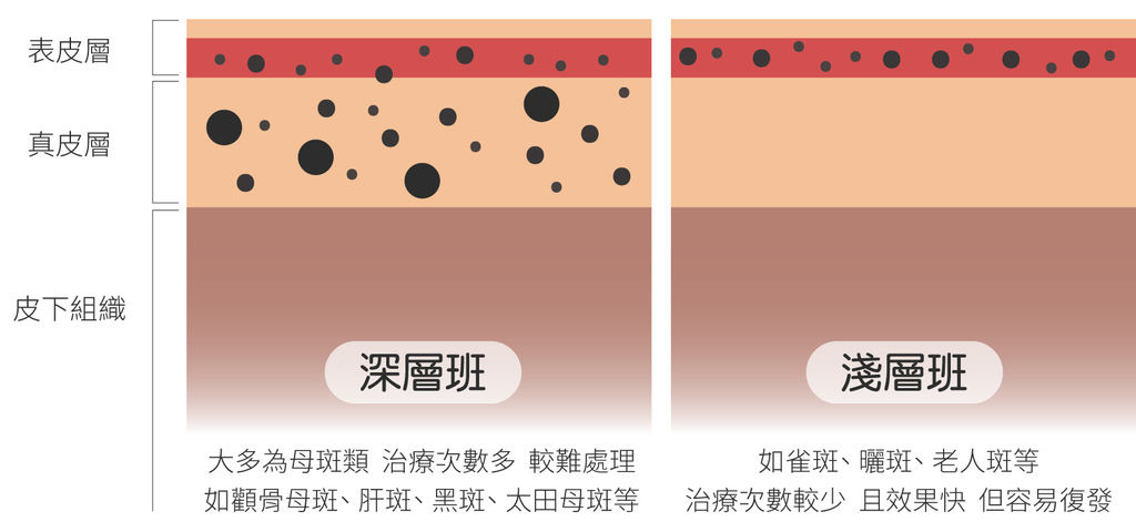 PicoSure755皮秒雷射蜂巢式聚焦陣列透鏡蜂巢透鏡皮秒雷射蜂巢皮秒雷射雀斑曬斑除斑痘疤毛孔細紋黑色素好膚質復原02.jpg