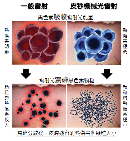 PicoSure755皮秒雷射蜂巢式聚焦陣列透鏡蜂巢透鏡皮秒雷射蜂巢皮秒雷射雀斑曬斑除斑痘疤毛孔細紋皮秒06.png