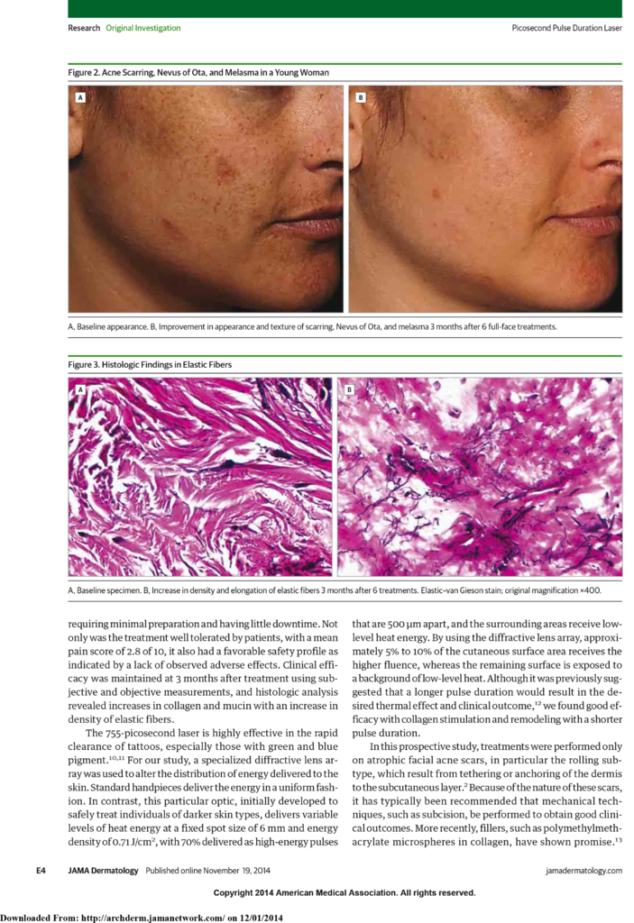 PicoSure 皮膚雷射755蜂巢皮秒雷射價格皮秒雷射多少錢皮秒雷射價格便宜雷射09.png PicoSure 皮膚雷射755蜂巢皮秒雷射價格皮秒雷射多少錢皮秒雷射價格便宜雷射09.png