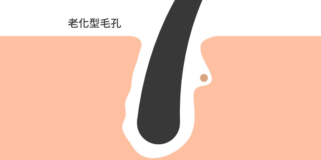 皮秒毛孔755皮秒雷射價格755皮秒雷射755蜂巢皮秒雷射蜂巢皮秒雷射皮秒蜂巢皮秒雷射推薦皮秒價格皮秒雷射多久打一次果酸換膚04.jpg 皮秒毛孔755皮秒雷射價格755皮秒雷射755蜂巢皮秒雷射蜂巢皮秒雷射皮秒蜂巢皮秒雷射推薦皮秒價格皮秒雷射多久打一次果酸換膚04.jpg