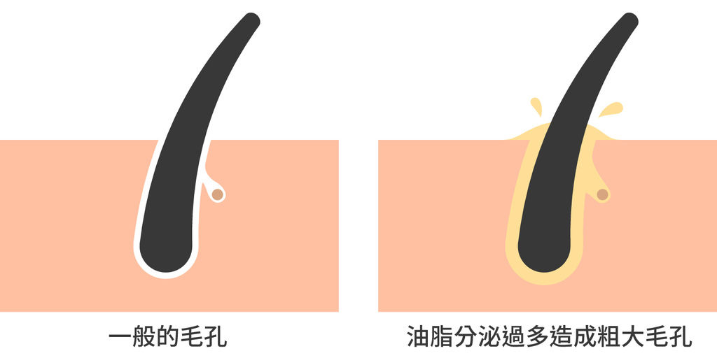 皮秒毛孔755皮秒雷射價格755皮秒雷射755蜂巢皮秒雷射蜂巢皮秒雷射皮秒蜂巢皮秒雷射推薦皮秒價格皮秒雷射多久打一次果酸換膚02.jpg 皮秒毛孔755皮秒雷射價格755皮秒雷射755蜂巢皮秒雷射蜂巢皮秒雷射皮秒蜂巢皮秒雷射推薦皮秒價格皮秒雷射多久打一次果酸換膚02.jpg