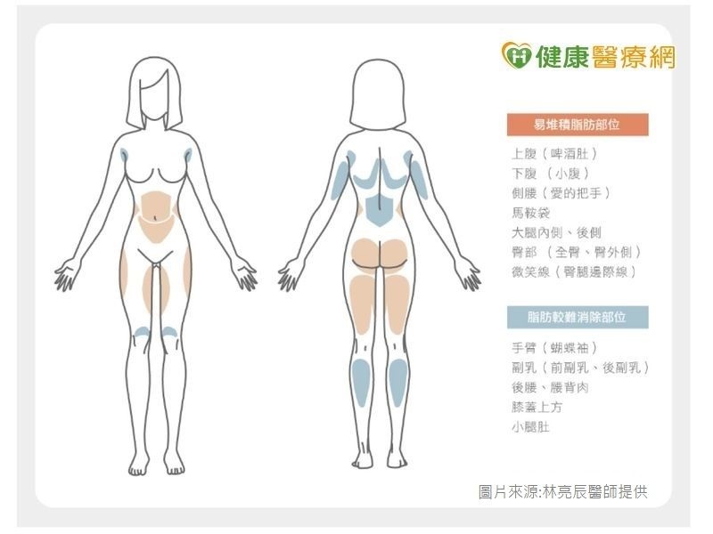 sculpsure絲酷秀體雕溶脂雷射減肥減脂抽脂瘦身塑身