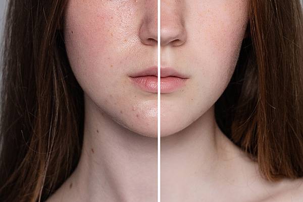 health-people-youth-beauty-concept-before-after-cosmetic-operation-young-pretty-woman-portrait-before-after-cosmetic-plastic-procedure-anti-age-therapy-treatment-PX1000.jpg