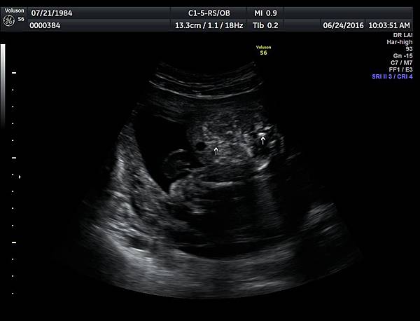 711-69-007 711-69-007