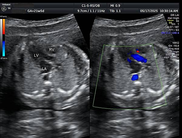 孕兒診所賴錫鉅醫師 461 如何避免糾紛，誠實是上策