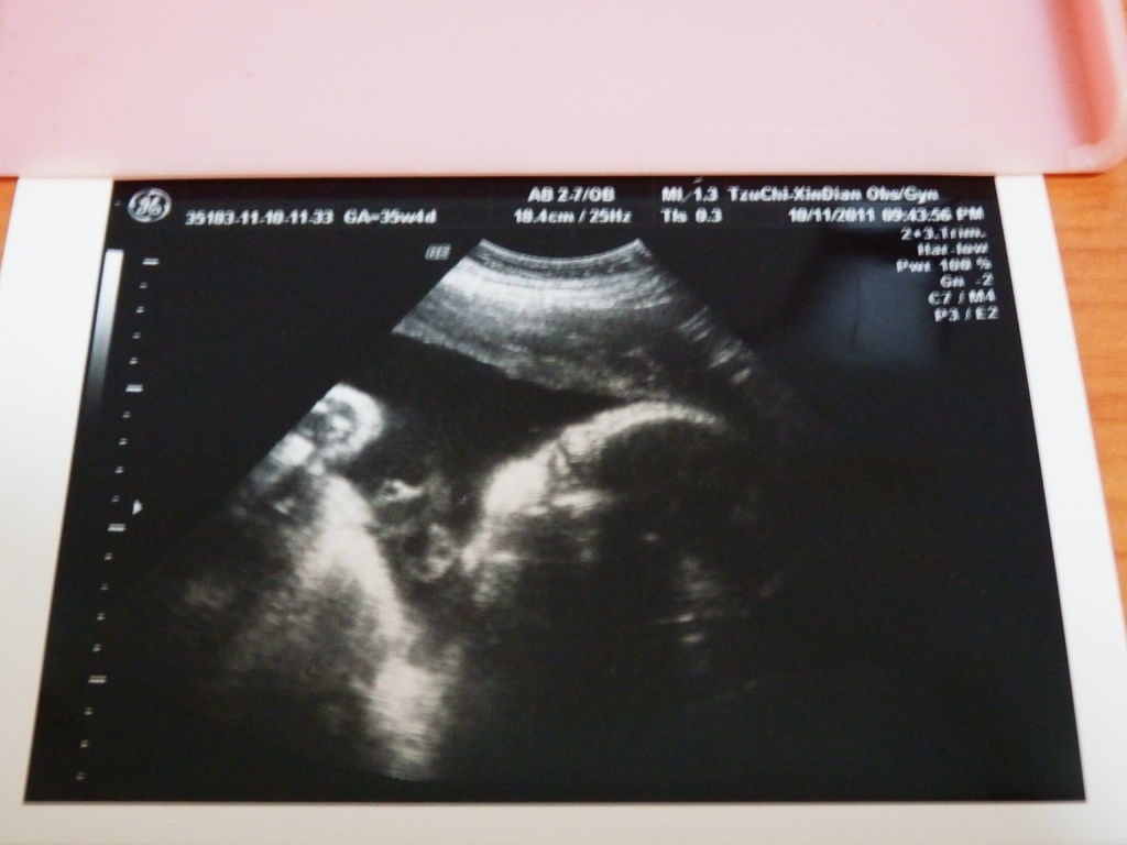 2011年10月11日鈺銘在媽咪肚子裡約235天