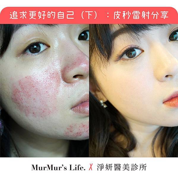 皮秒-00-01.jpg 皮秒-00-01.jpg