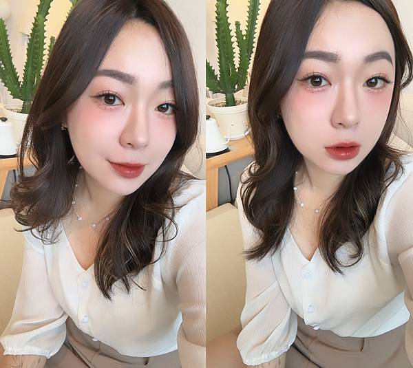 醫美放鬆咀嚼肌肉毒小臉術Dysport皇家肉毒台中悠美 醫美放鬆咀嚼肌肉毒小臉術Dysport皇家肉毒台中悠美