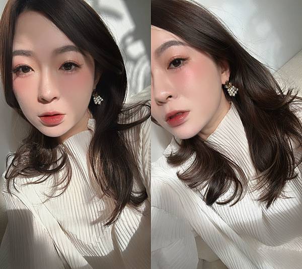 醫美放鬆咀嚼肌肉毒小臉術Dysport皇家肉毒台中悠美 醫美放鬆咀嚼肌肉毒小臉術Dysport皇家肉毒台中悠美