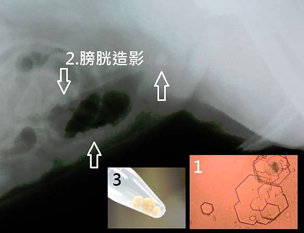 擷取