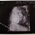 37w5d-1.jpg