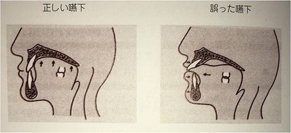 正確與錯誤吞嚥（引述自MFT入門―初歩から学ぶ口腔筋機能療法）.jpg