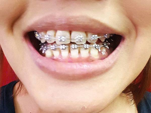 IMG_20160816_072335.jpg IMG_20160816_072335.jpg